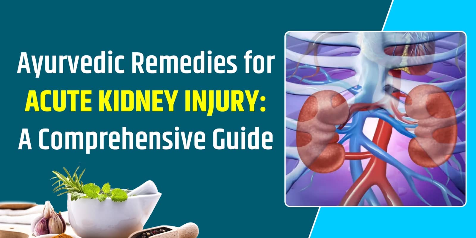 Ayurvedic Remedies for Acute Kidney Injury: A Comprehensive Guide